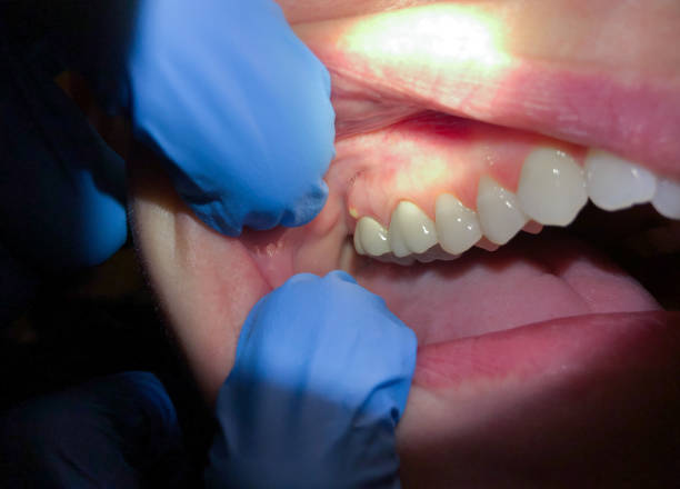 Best Tooth Infection Emergency Dentist  in Enigma, GA