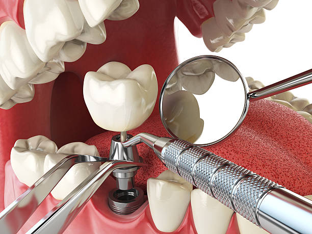 Best Cracked Tooth Emergency Dentist  in Enigma, GA